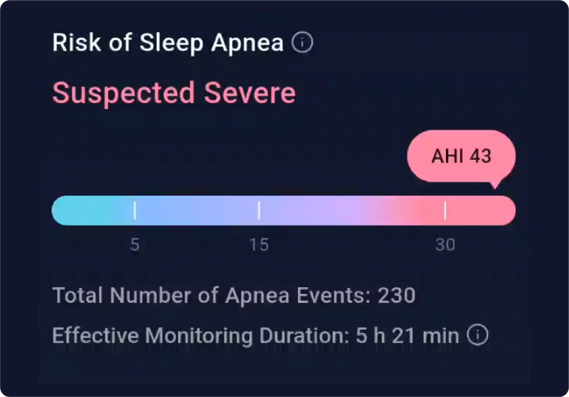 OSA Risk Level Assessment (informative image)